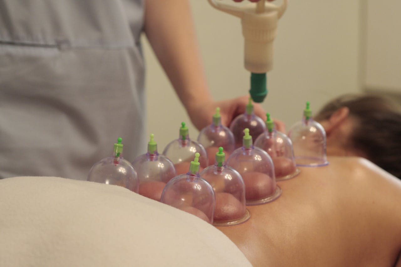 Close-up of a relaxing cupping therapy session in a soothing spa environment.