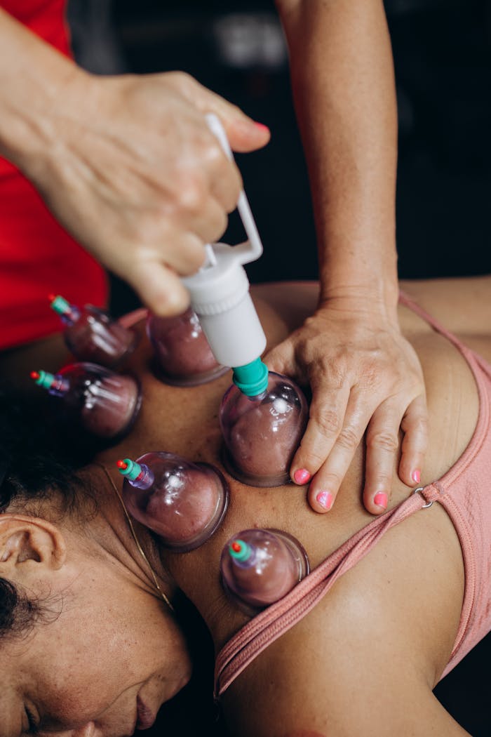 gallery-6 Close-up of cupping therapy on a woman's back, focusing on muscle recovery and relaxation.