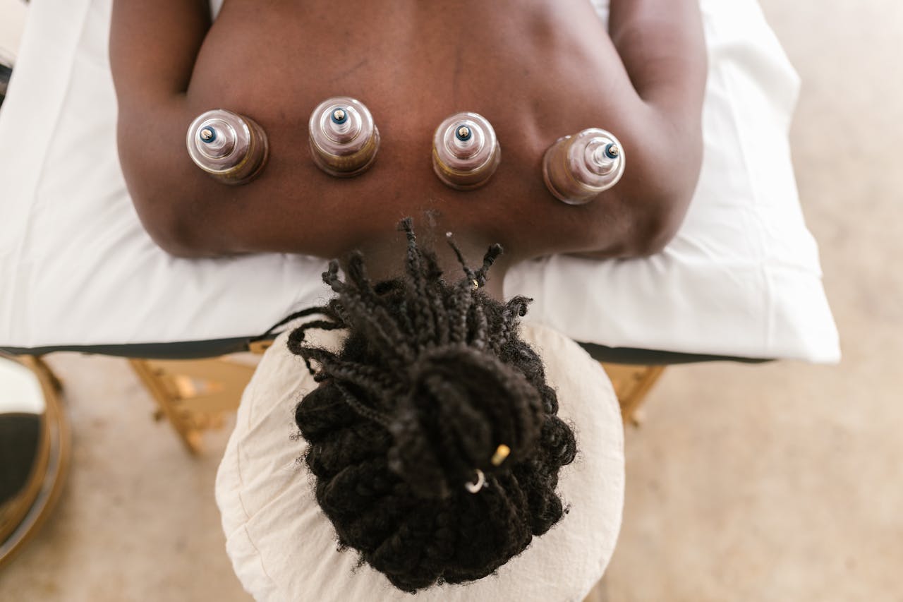 gallery-5 Top view of a cupping therapy session highlighting holistic treatment and relaxation.